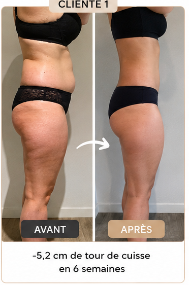 Cliente 1 avant-après : -5,2 cm de tour de cuisse en 6 semaines